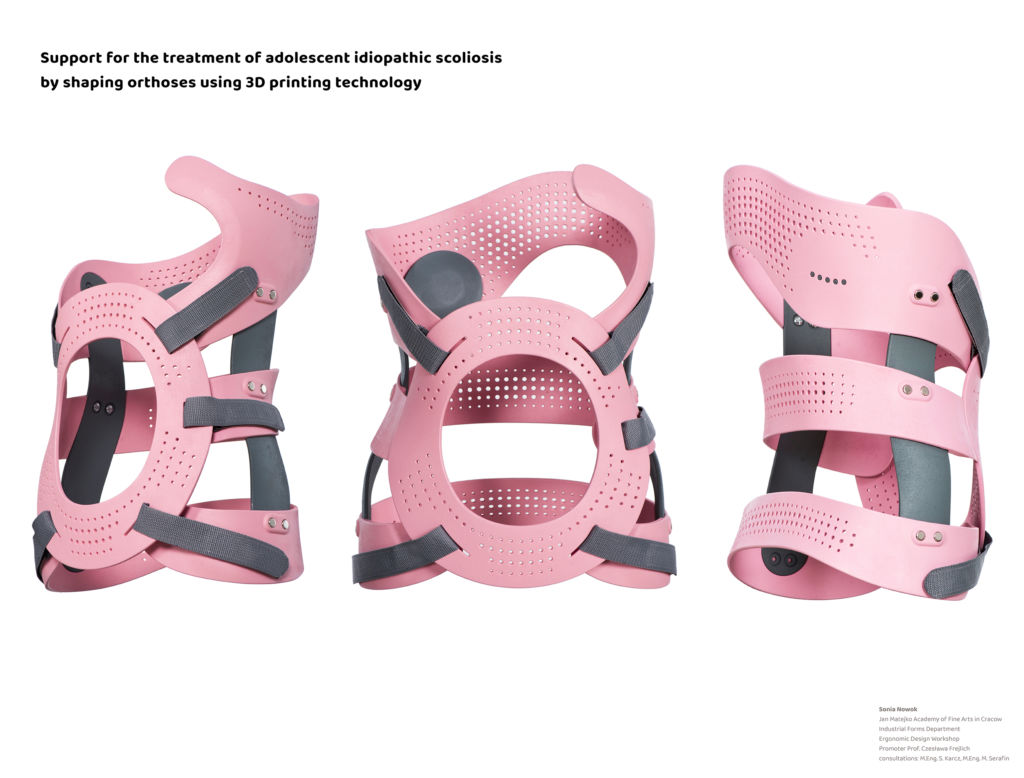 Care with comfort: New 3D-printed braces give relief for kids with scoliosis